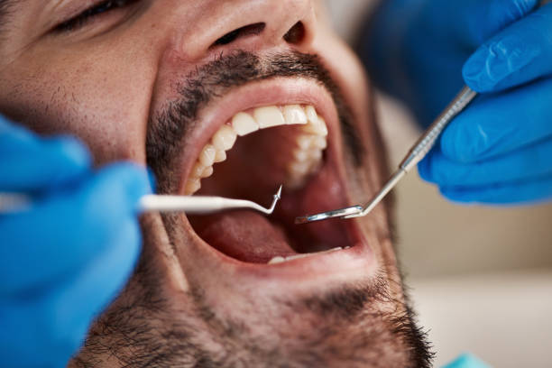Best Tooth Infection Emergency Dentist  in Ford Heights, IL