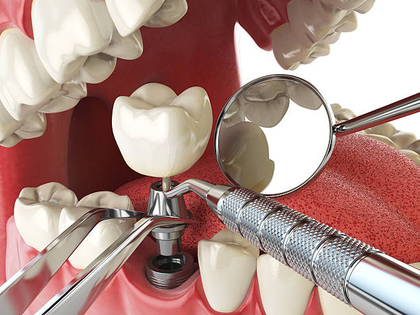 Best Urgent Tooth Repair  in Ford Heights, IL